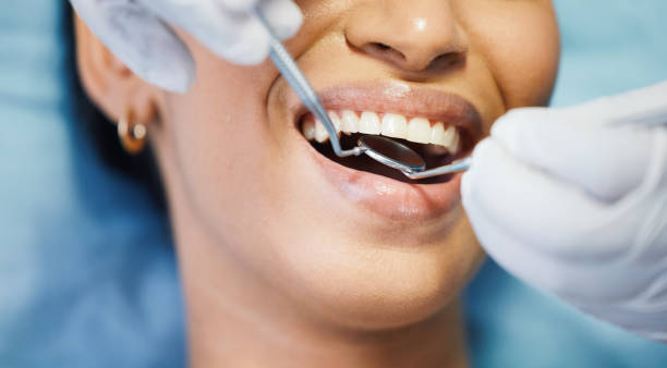 Best Emergency Denture Repair in Pioneer, OH